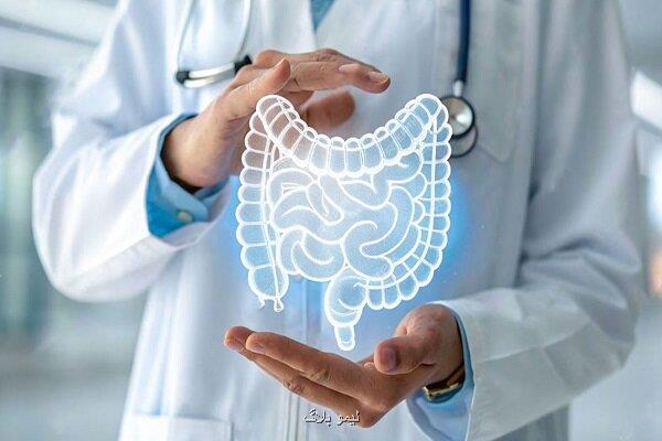 شروع تولید پیش بالینی داروی نانویی برای درمان سرطان روده