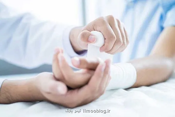 نوآوری ایرانی در ترمیم زخم و صرفه جویی ۱۵، ۲ میلیون دلاری ارزی