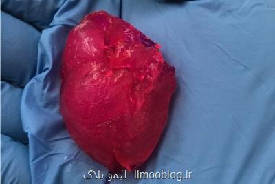 قلب مینیاتوری با پرینتر زیستی تولید شد