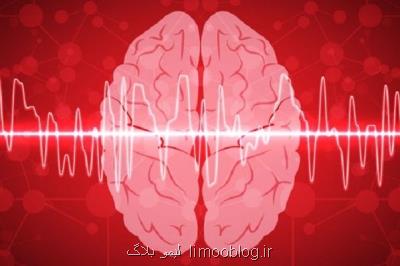 همایش ملی هوش مصنوعی در تصویر برداری پزشكی برگزار می گردد